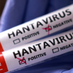 dunya-saglik-orgutu-baskanindan-hantavirus-mesaji-bu-yeni-bir-covid-19-degil-DuAnMIeg.jpg