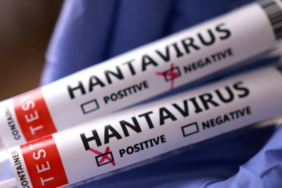 dunya-saglik-orgutu-baskanindan-hantavirus-mesaji-bu-yeni-bir-covid-19-degil-DuAnMIeg.jpg