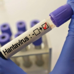 grip-ile-karistiriliyor-uzmanlardan-hantavirus-aciklamasi-RS9JGluU.jpg