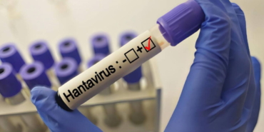 grip-ile-karistiriliyor-uzmanlardan-hantavirus-aciklamasi-RS9JGluU.jpg
