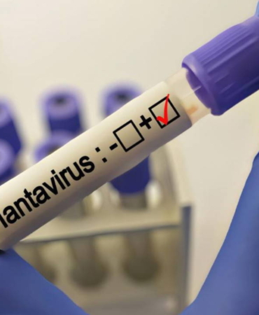 grip-ile-karistiriliyor-uzmanlardan-hantavirus-aciklamasi-RS9JGluU.jpg