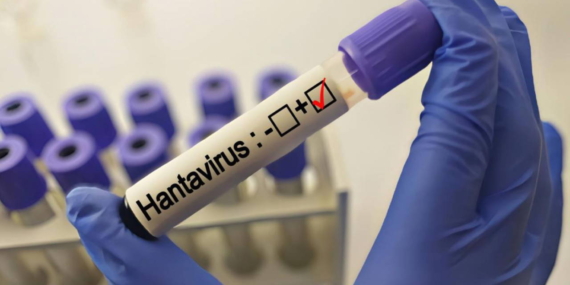 grip-ile-karistiriliyor-uzmanlardan-hantavirus-aciklamasi-RS9JGluU.jpg